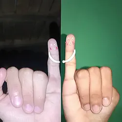 pinky finger trend