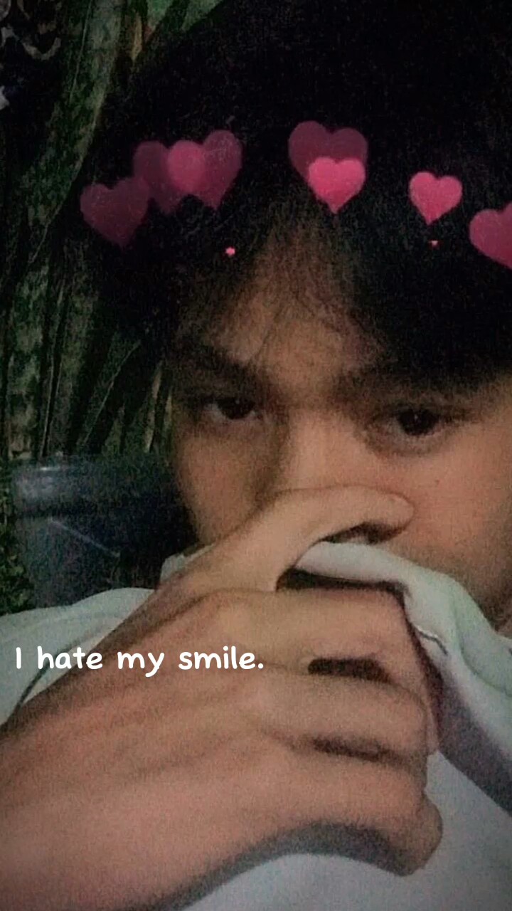 I HATE MY SMILE BUT