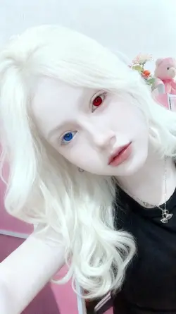 Albino Eyes Red-Blue