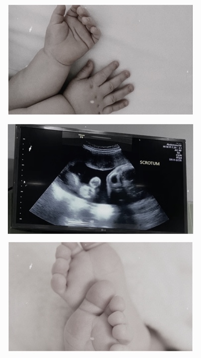 Pregnant 
