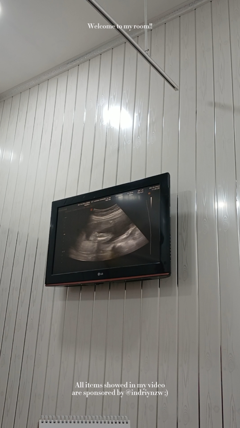 usg gender reveal