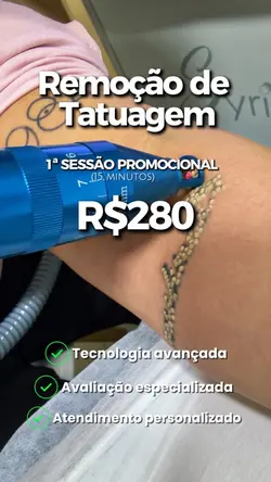 Remoção de tatuagem