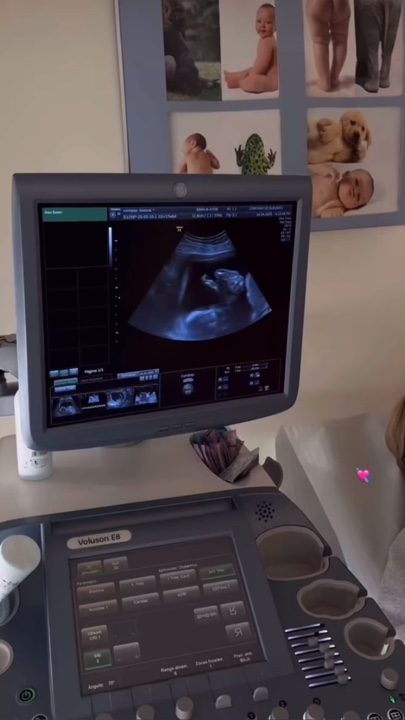 Baby ultrasound
