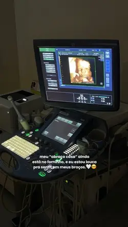 abraço casa