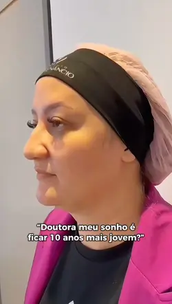 Harmonização facial
