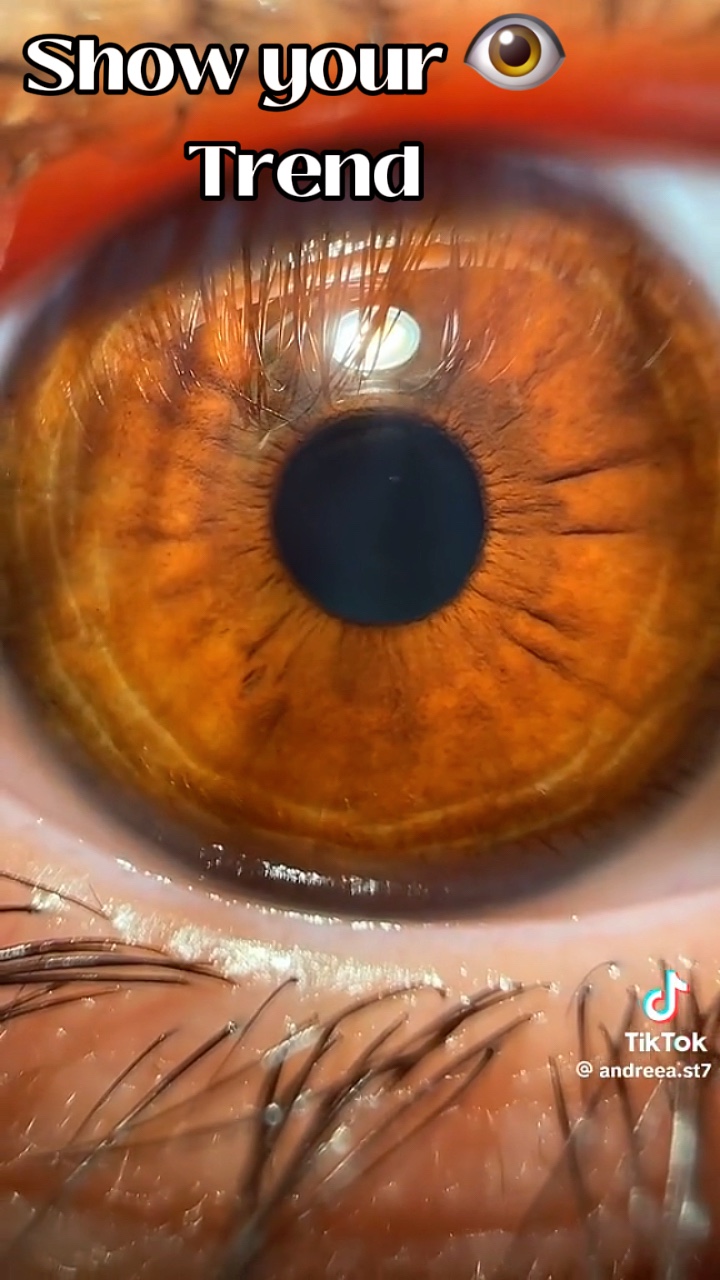 Tendência de cor dos olhos