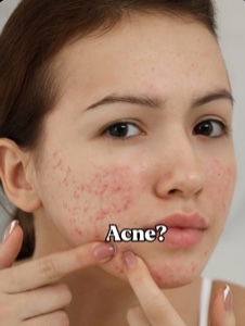 Skincare 